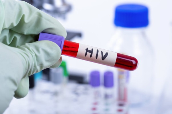 VIH au Togo : miser sur la prévention pour tarir l’épidémie à la source